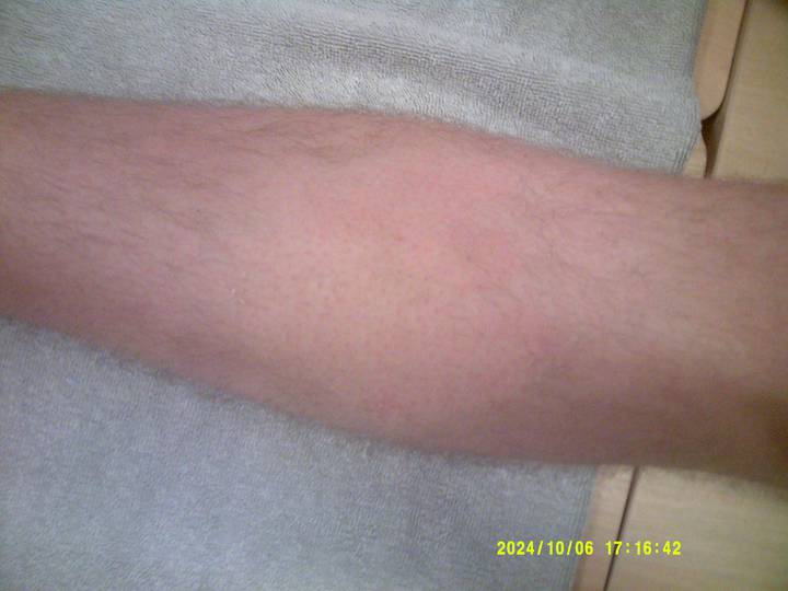 fuan-voksning/20241006171642_00