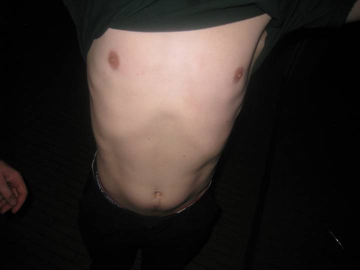 olsmagning-m-olsnedkeren/20260327230925_00