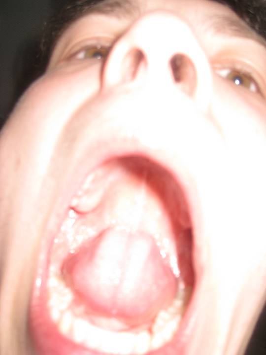 olsmagning-m-olsnedkeren/20260328032946_00